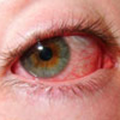 sometimes i dont have tired eyes