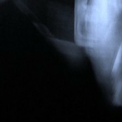 So you think you lost your mind, häh - part1 2012-08-04 16h56m44
