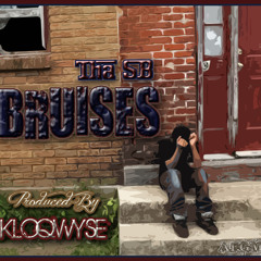 BRUISES