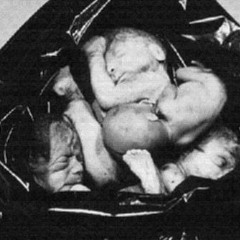 ABCDE - Aborted Child Response (Prod. VTZ)