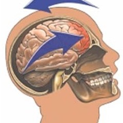 FonkaliciousConcussions