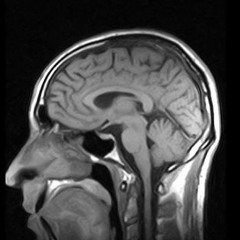 Vicky Merlino - NeuroVision-(Original Mix-DEMO-)work in prog.