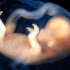 24 - A Nova Estratégia Mundial do Aborto