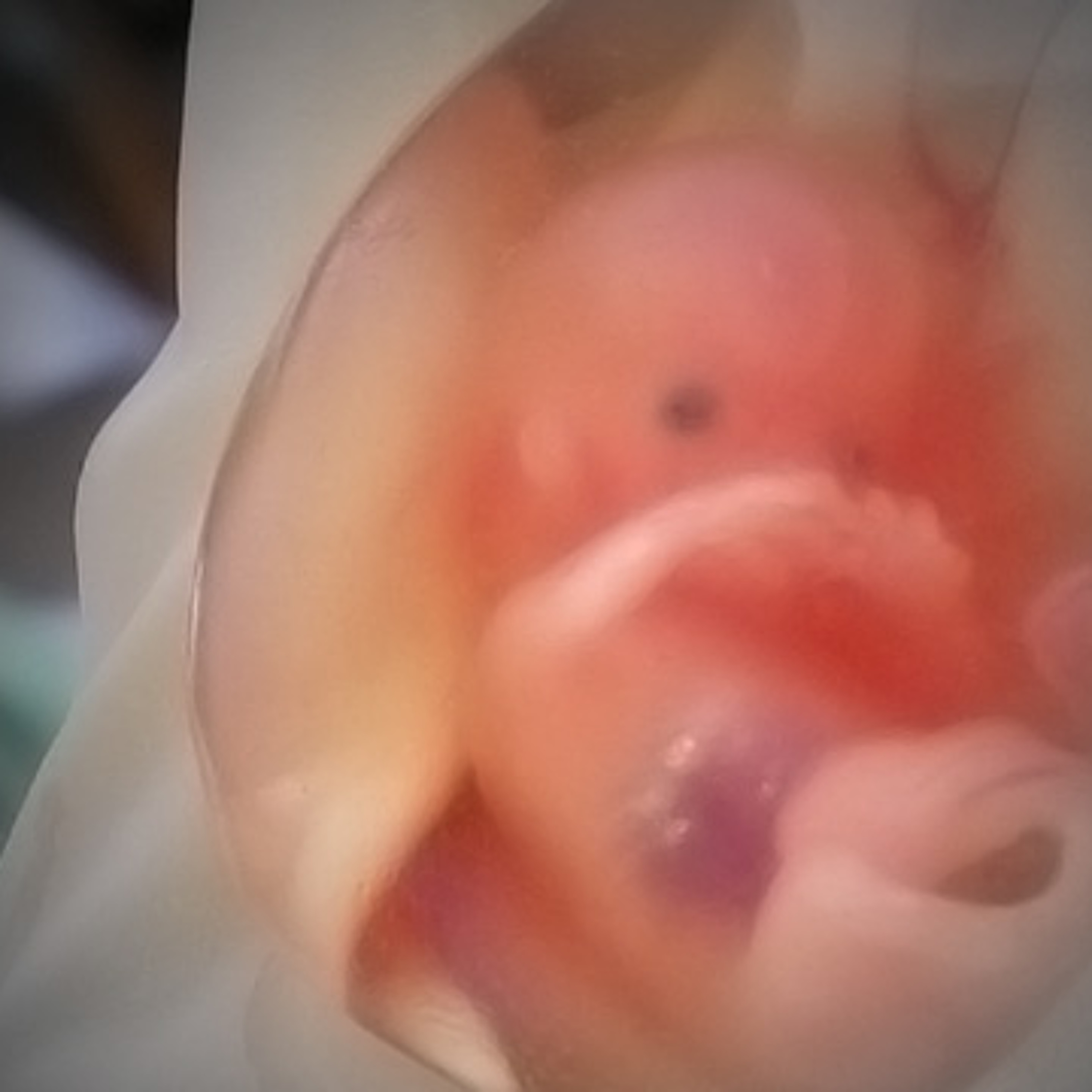 AV.28 - Estudo do documento "Nova Estratégia Mundial do Aborto" - Quinta Aula episode artwork