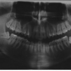 Spitting Diamonds Ft. Romy HarmonyMSTR