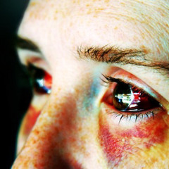 In My Skin