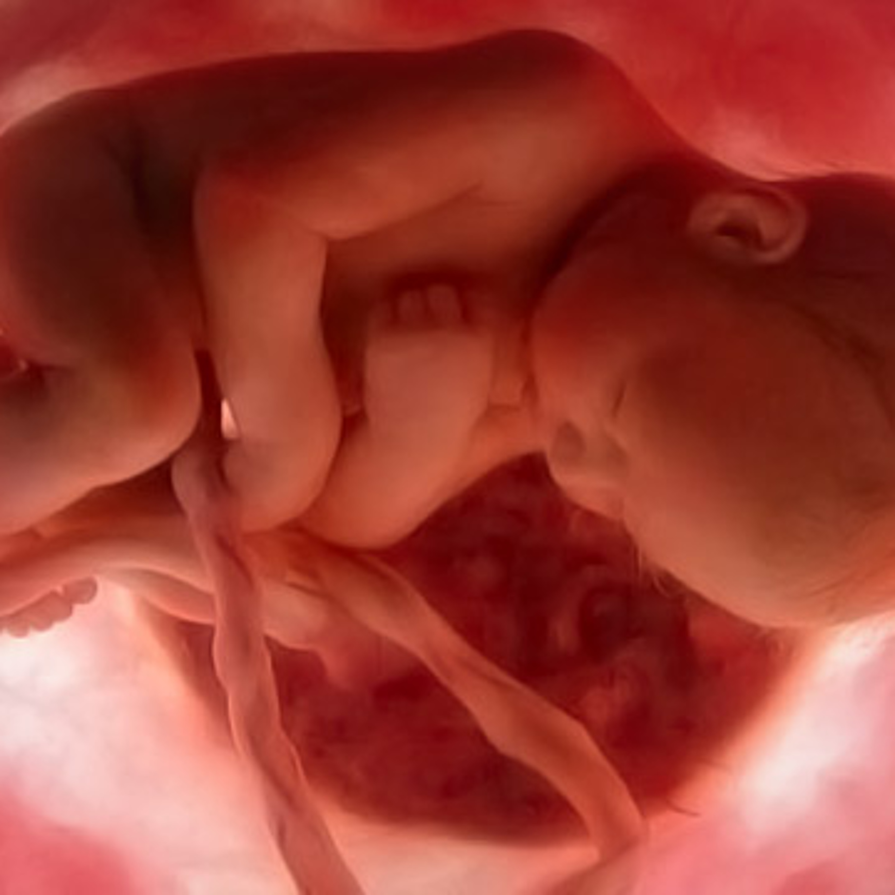 AV.29 - Estudo do documento "Nova Estratégia Mundial do Aborto" - Sexta Aula episode artwork