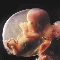 Kiara Miller - Birth