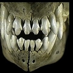 Dickie-Big teeth (remix by Dickie)