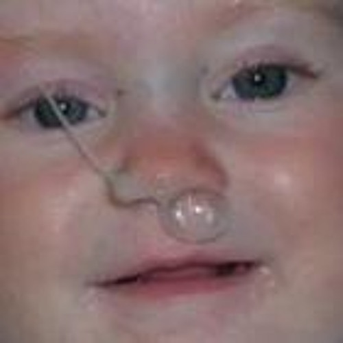 Snotty nose deals