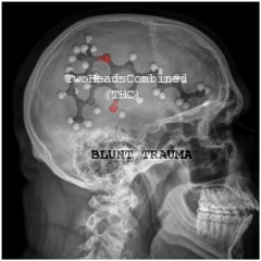 Vonson - "Da Kill" (Prod. Harry Fraud)