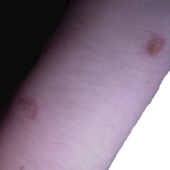 Kerosene (Ingestrogen Edit)