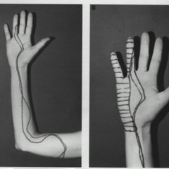 Skinny Love {Skin Deep Remix}