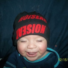 Noisear-Karma Suture