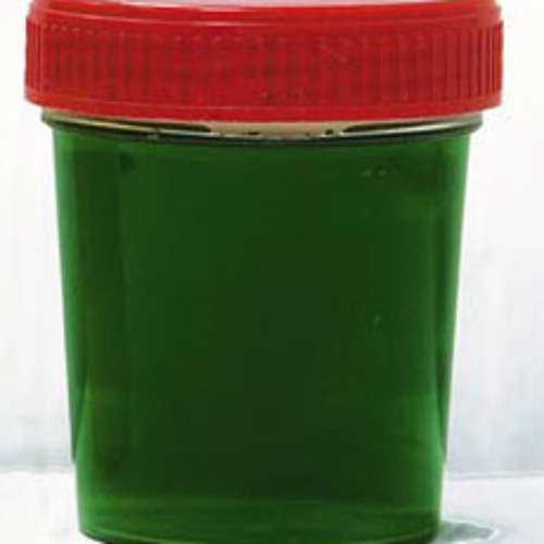 зеленая мочь. желто зеленая моча. салатовая моча. моча зеленого цвета. зеленая моча.