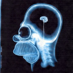 Radium - No brain required (Maynor remix)