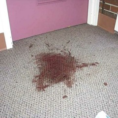 Can you get blood stains out of a carpet?