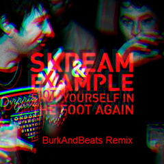 Skream & Example - Shot yourself in the foot again (BurkAndBeats Remix)