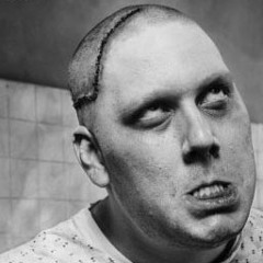 TreAvel "Lobotomia simulata"