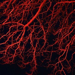 Dark dark heart (dubstep yellow mix)