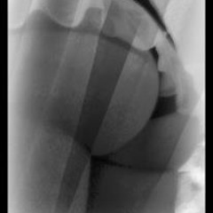 Oh My Ft €ollizion42