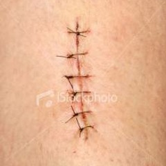 01 nEEd stitCheS (the diRECtor's Cut) feat Nite Boogie & Phil G produced by BBOY Enea