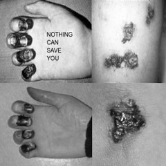 Nothing Can Save You