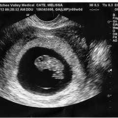 Heartbeat- Lily 22 weeks