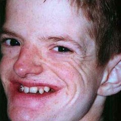 Subsizion - Fxkin Piece Of Shit