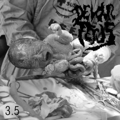 First abortion for dinner