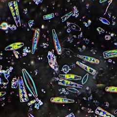 A Strange Dream about Diatoms & Plankton