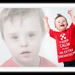 DerpSTeP - ok im ready