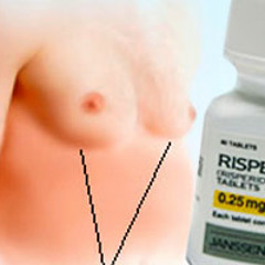 Risperdal Causes Males To Grow Breasts?