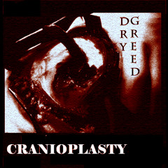 Cranioplasty
