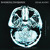Artwork for Breaking Benjamin - Without You (Acoustic)