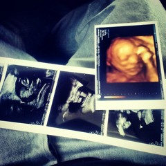 Dots aka Joey Patron - Before You Arrive (ALEAH)