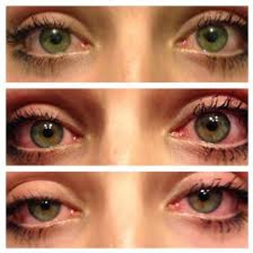 Japanese Eyes by M.I.L.K. (Kev Kill x A.Millz) 2013