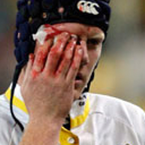 Peter Kimlin-Secret To Beating Lions