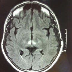 Apnea                       [Prod. Rels Beats]