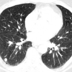 Dreamkick - Through the cracks