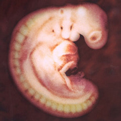 Demiàn Visgarra - Renacimiento visceral