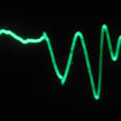 Frequency (GoA MiNiMaLe)