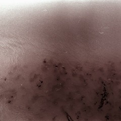 Murmur (Acoustic BBC Introducing Session)