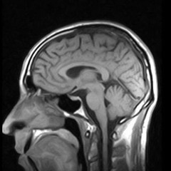 aran project-neurovision (drumatix remix)