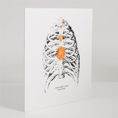 Tethered Heart