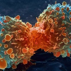 Cancer (acoustic)