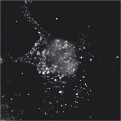 Apoptosis