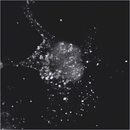 Apoptosis