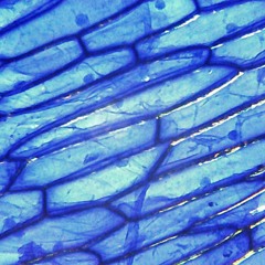 Revolver...(Cebolla de Cristal)