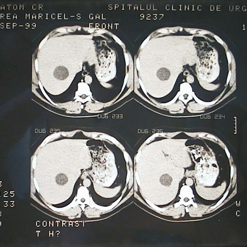 pied. Tomijs,Chuks - Čist, čist, čist